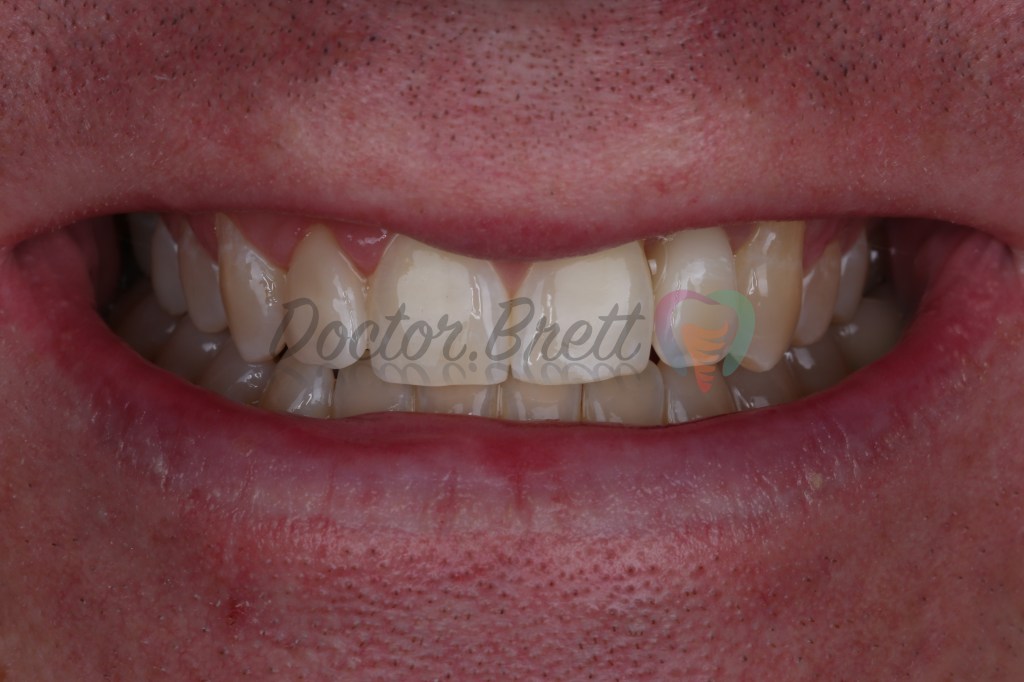 Photographs and restoration courtesy of Dr. Michael Andersen